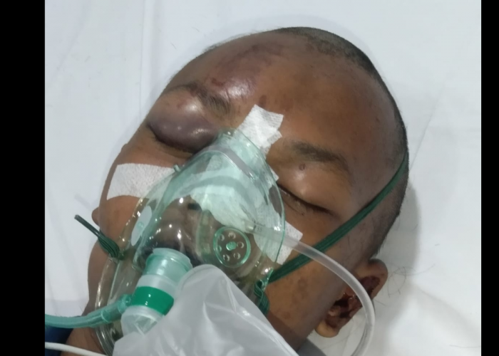 4 Bulan Kasus Dugaan Kekerasan Anak Belum Tuntas, Keluarga Korban Pertanyakan Kinerja Polisi