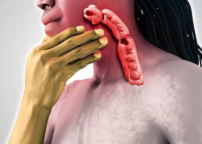 7 Tips Mencegah Radang Tenggorokan Setelah Lebaran