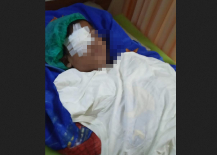 Anak Korban Lato-lato Jalani Operasi Mata Kanan, Tetap Hati-hati Ya