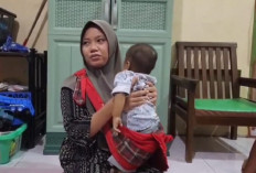 Derita Bayi 8 Bulan Asal Cirebon Idap Atresia Bilier, Transplantasi Hati Jadi Satu-satunya Harapan