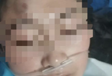 Ditolak Cinta, Dokter Spesialis Diduga Aniaya Perawat di Cirebon hingga Nyaris Pingsan