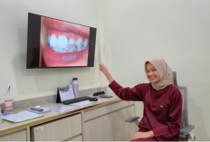 Senyum Lebih Percaya Diri, Ini Ragam Perawatan Estetika Gigi di Cirebon yang Banyak Dicari