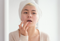 Bukan Cuma Kurang Minum, Ini 5 Kebiasaan Sepele yang Bikin Bibir Gelap dan Pecah-pecah