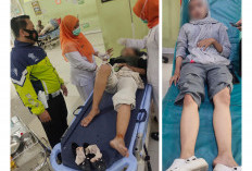 Diduga Kurang Konsentrasi, Dua Remaja Putri Kecelakaan di Pantura Cirebon
