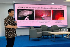 HIPEC Hadir di Primaya Hospital Kelapa Gading,Terapi Canggih Tingkatkan Harapan Hidup Pasien Kanker Peritoneal